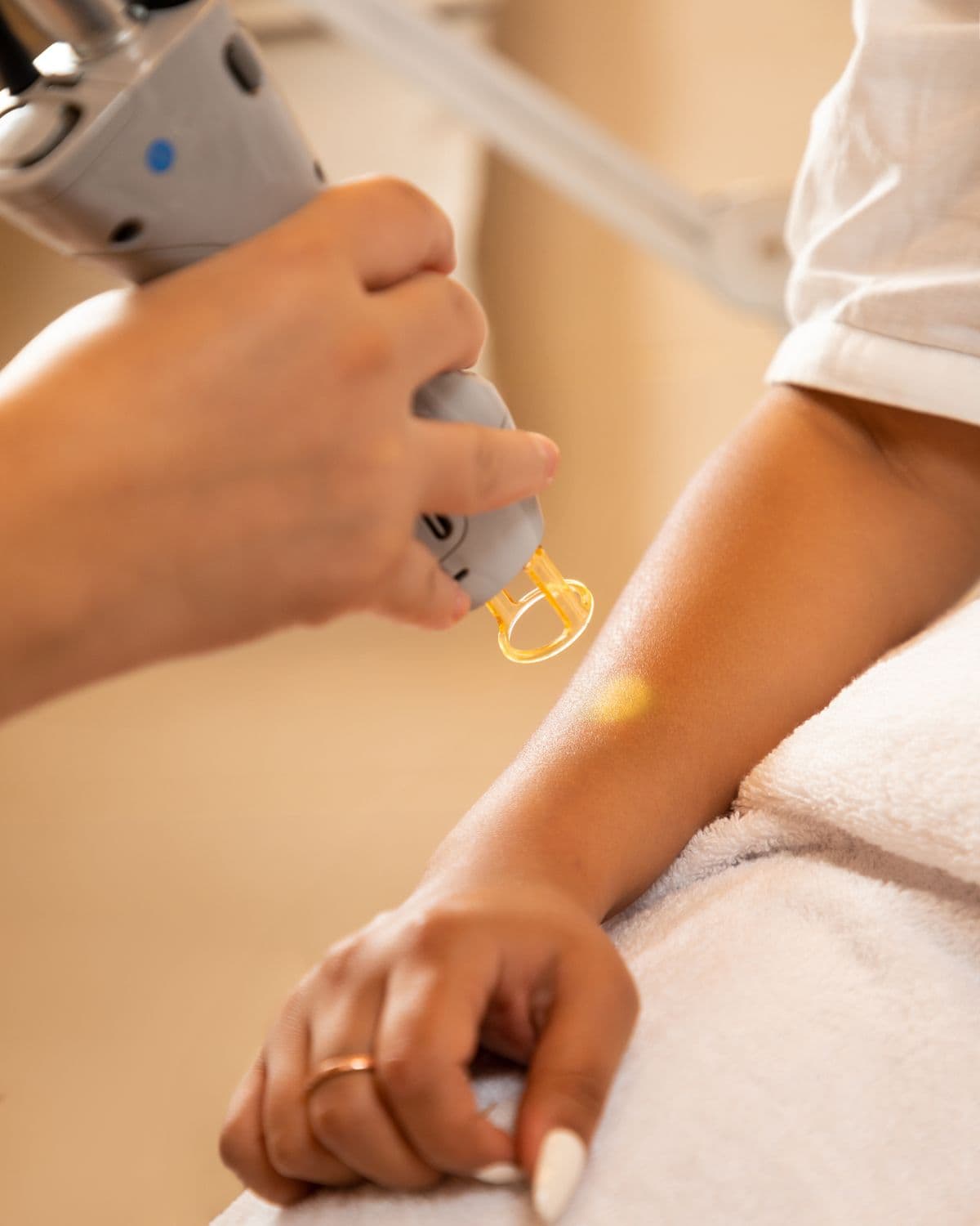A professional laser hair removal treatment